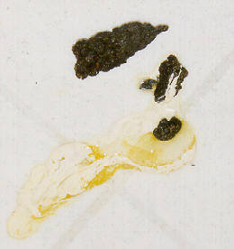 giardia green poop